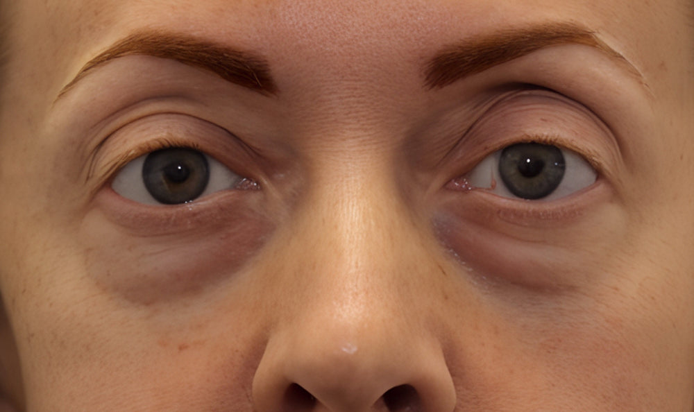 image comparison before