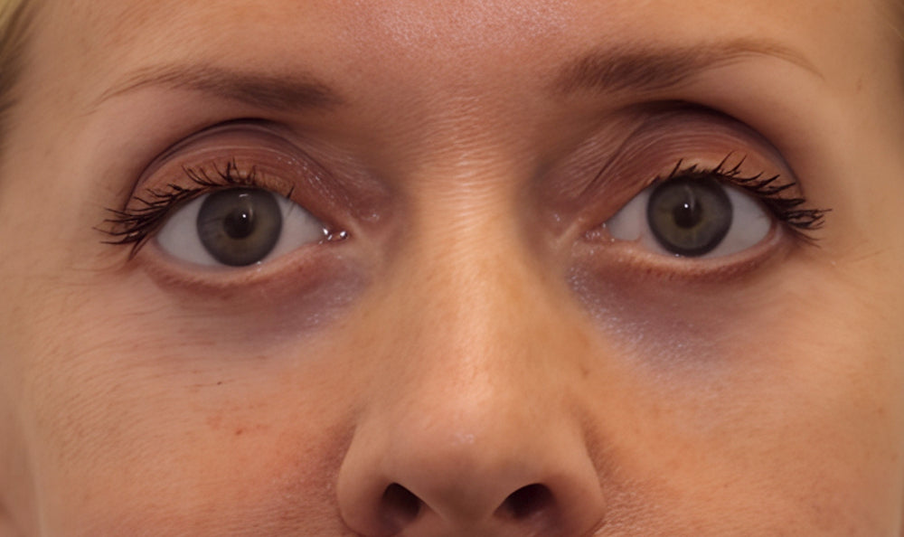 image comparison after